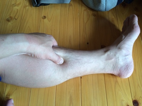 速攻で足のむくみを取るために テーピングマスターで治療家山田敬一の整骨院経営ブログ